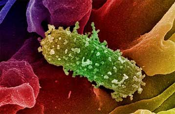Η Escherichia coli ζει κανονικά στο ανθρώπινο έντερο